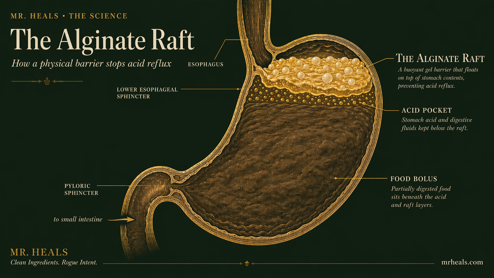What Is an Alginate Raft and How Does It Work?